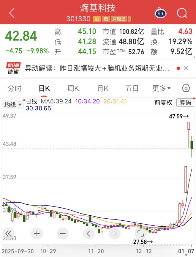 脑接口概念股__脑机接口技术股票